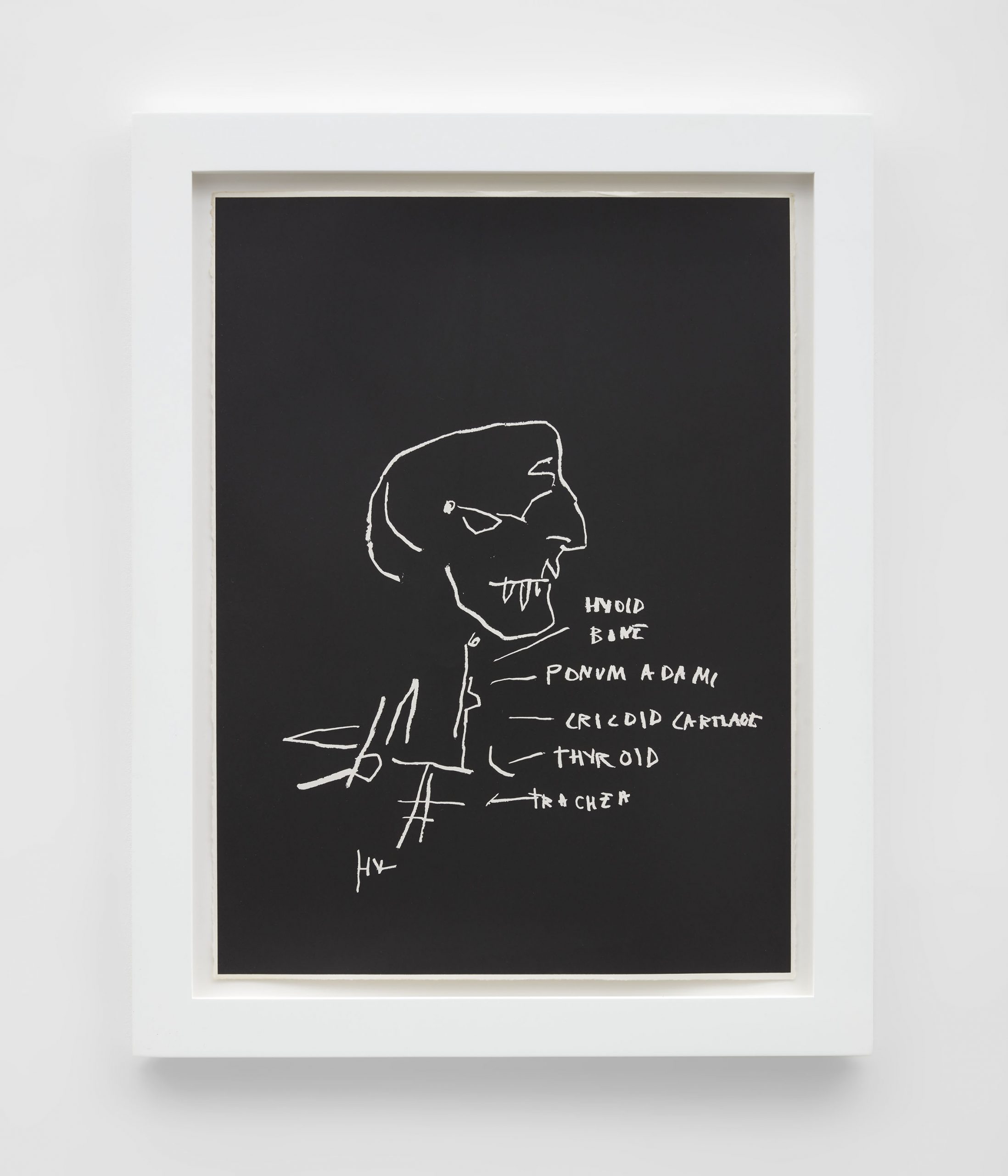 Jean-Michel Basquiat Thyroid